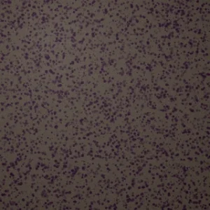 Texture 02 Speckle Bronze patch colour